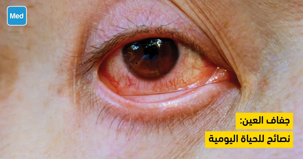 جفاف العين: نصائح للحياة اليومية